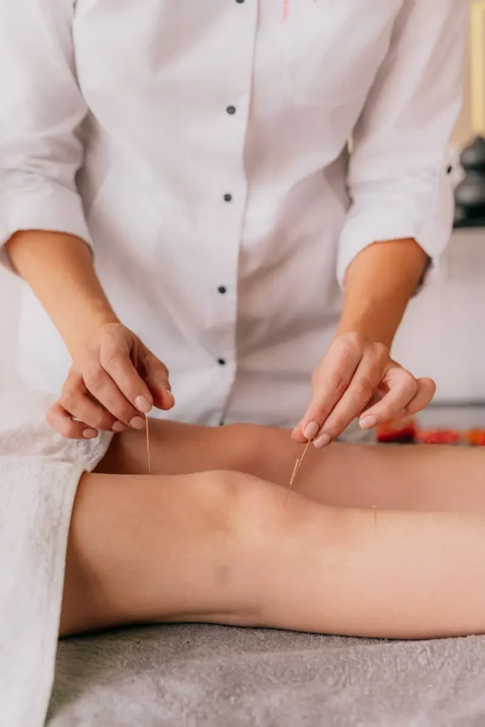 Client having acupuncture on their knee by an acupuncture specialist